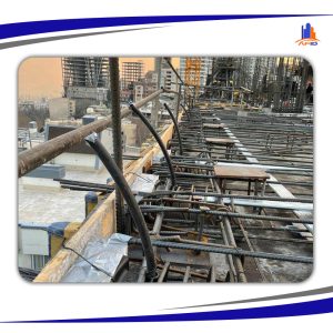 هر آنچه درباره پس کشیدگی باید بدانیم